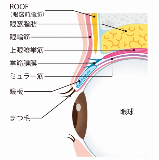 上まぶたのたるみを取る方法（比較）