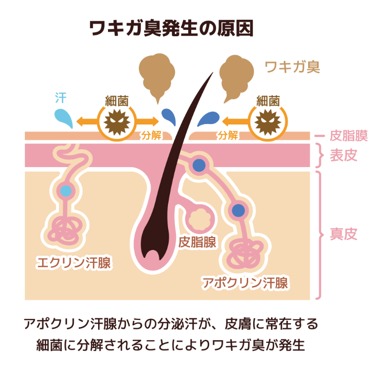 ワキガの原因